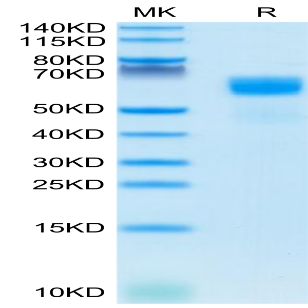 Human SG3/Secretogranin 3 Protein (SGS-HM101)