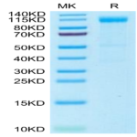 Rhesus macaque Siglec-2/CD22 Protein (SIG-CM122)