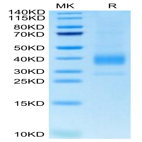 Biotinylated Cynomolgus Siglec-15/CD33L3 Protein (SIG-CM415B)
