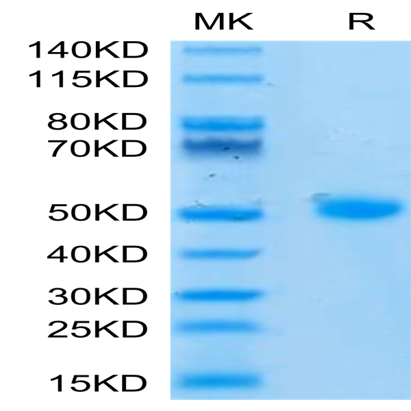 Human CD209/DC-SIGN Protein (SIG-HM101)