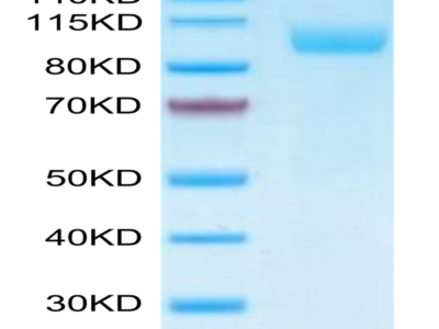 Biotinylated Human Siglec-5/CD170 Protein (Primary Amine Labeling) (SIG-HM205B)