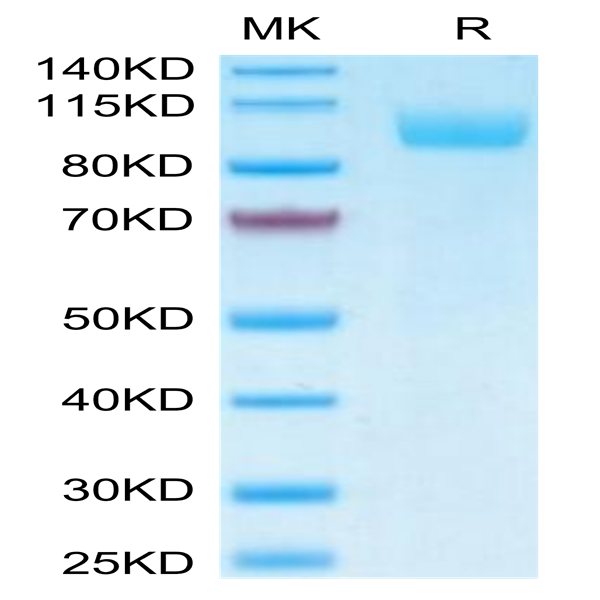 Biotinylated Human Siglec-5/CD170 Protein (Primary Amine Labeling) (SIG-HM205B) Biotinylated Human Siglec-5/CD170 Protein (Primary Amine Labeling) (SIG-HM205B)