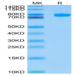 Human Siglec-8 Protein (SIG-HM208)