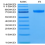 Human Siglec-10 Protein (SIG-HM210)