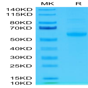 Human Siglec-15/CD33L3 Protein (SIG-HM215)