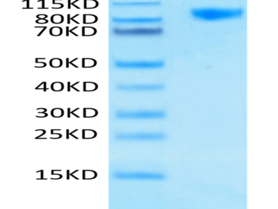 Human Siglec-9 Protein (SIG-HM219)