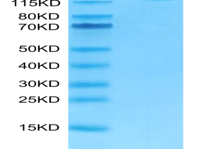 FITC-Labeled Human Siglec-2/CD22 Protein (SIG-HM222F)