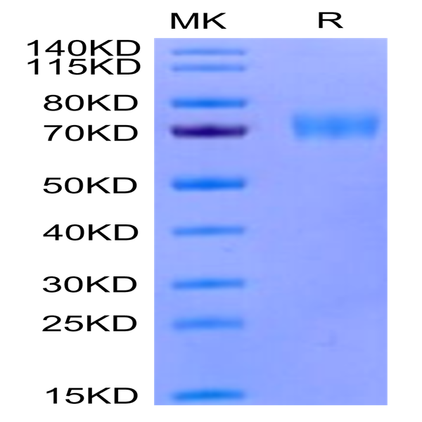 Human Siglec-5/CD170 Protein (SIG-HM405)