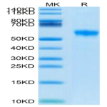Biotinylated Human Siglec-8 Protein (SIG-HM408B)