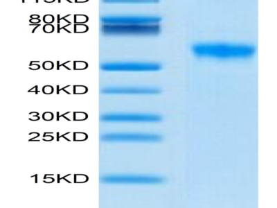 Biotinylated Human Siglec-8 Protein (SIG-HM408B)