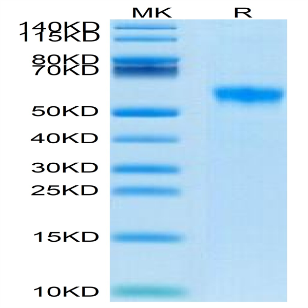 Biotinylated Human Siglec-8 Protein (SIG-HM408B) Biotinylated Human Siglec-8 Protein (SIG-HM408B)