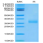 Human Siglec-15/CD33L3 Protein (SIG-HM415)