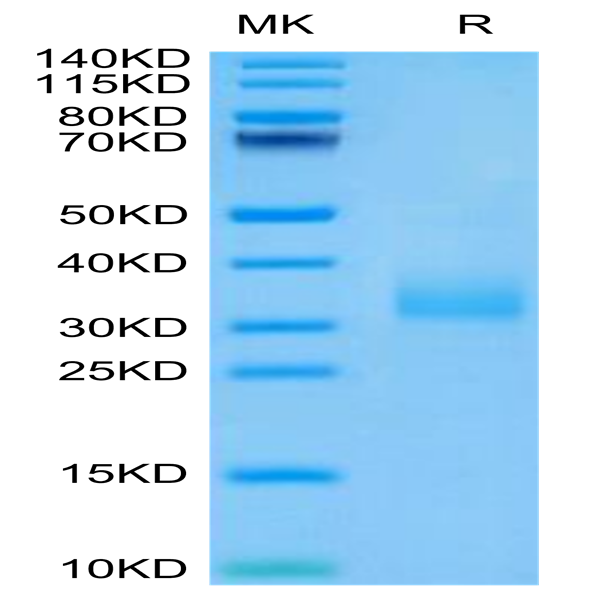 Human Siglec-15/CD33L3 Protein (SIG-HM415)