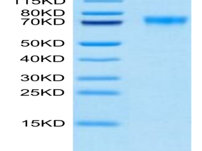 Biotinylated Human Siglec-9 Protein (SIG-HM419B)