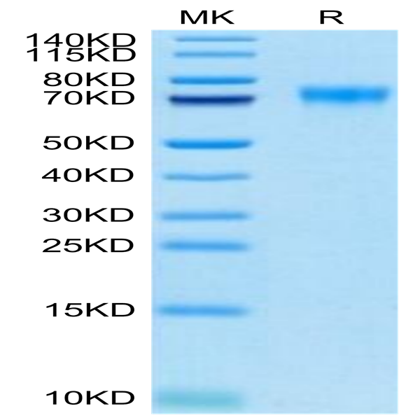 SIG-HM419B Biotinylated Human Siglec-9 Protein (SIG-HM419B)