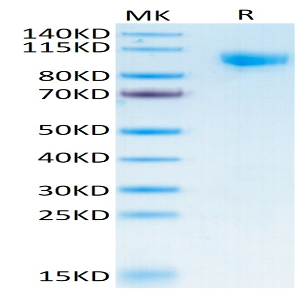 Human Siglec-10 Protein (SIG-HM510)