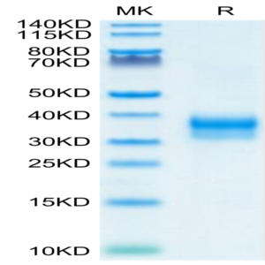 Mouse Siglec-15/CD33L3 Protein (SIG-MM115)