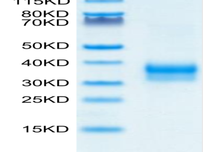 Mouse Siglec-15/CD33L3 Protein (SIG-MM115)