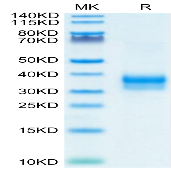 Mouse Siglec-15/CD33L3 Protein (SIG-MM115) Mouse Siglec-15/CD33L3 Protein (SIG-MM115)