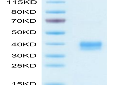 Biotinylated Mouse Siglec-15/CD33L3 Protein (Primary Amine Labeling) (SIG-MM115B)