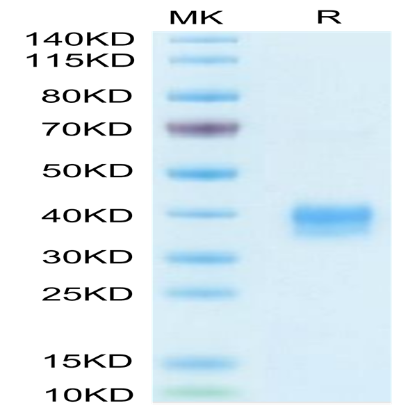 Biotinylated Mouse Siglec-15/CD33L3 Protein (Primary Amine Labeling) (SIG-MM115B) Biotinylated Mouse Siglec-15/CD33L3 Protein (Primary Amine Labeling) (SIG-MM115B)