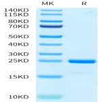 Human SKP1 Protein (SKP-HM401)