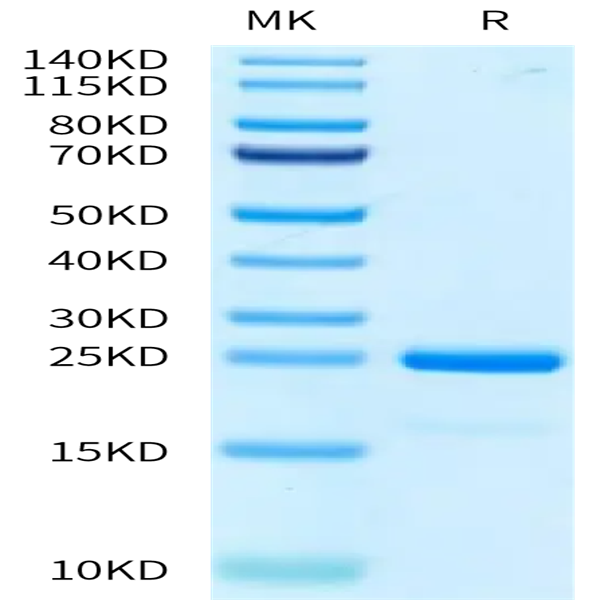 Human SKP1 Protein (SKP-HM401)