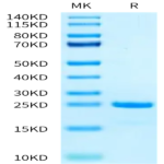 Biotinylated Human SKP1 Protein (SKP-HM401B)
