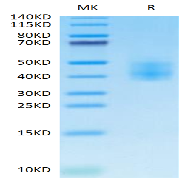 Cynomolgus SLAMF6/NTB-A Protein (SLA-CM1F6)