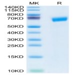 Human SLAMF6/NTB-A Protein (SLA-HM2F6)