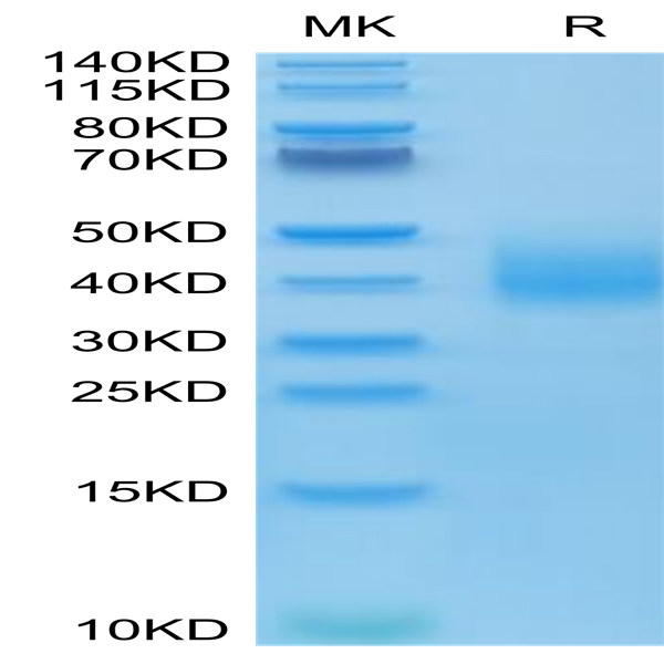 Human SLAMF6/NTB-A Protein (SLA-HM4F6)