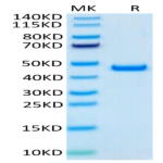 Human SLPI Protein (SLP-HM201)