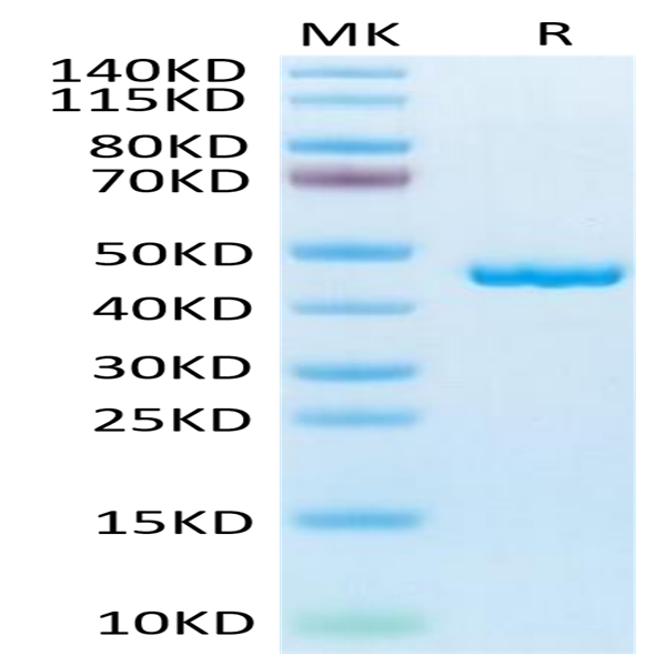 Mouse SLPI Protein (SLP-MM201)