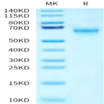 Human SMOC1 Protein (SMC-HM101)