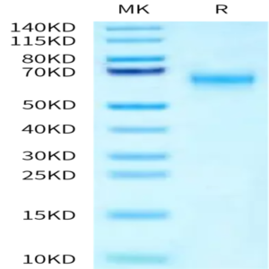 Human SMOC1 Protein (SMC-HM101)