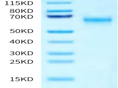 Human SMOC1 Protein (SMC-HM101)