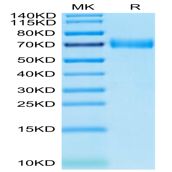 Human SLAMF7/CRACC/CD319 Protein (SMF-HM207)