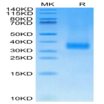 Cynomolgus SOST/Sclerostin Protein (SOT-CM101)