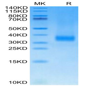 Cynomolgus SOST/Sclerostin Protein (SOT-CM101)