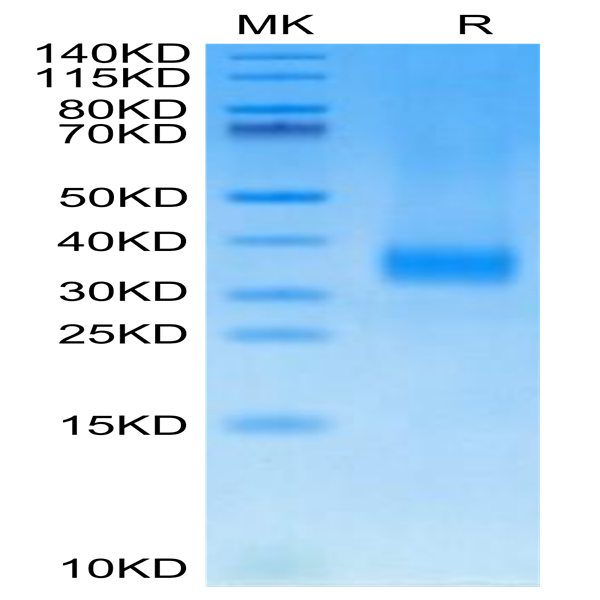 Cynomolgus SOST/Sclerostin Protein (SOT-CM101)