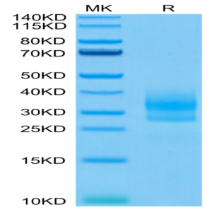 Human SOST/Sclerostin Protein (SOT-HM401)