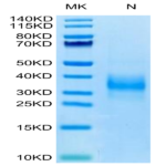 Biotinylated Human SOST/Sclerostin Protein (SOT-HM401B)
