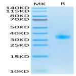 Mouse SOST/Sclerostin Protein (SOT-MM101)