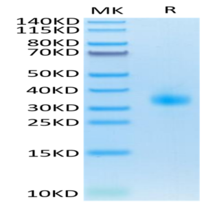 Mouse SOST/Sclerostin Protein (SOT-MM101)