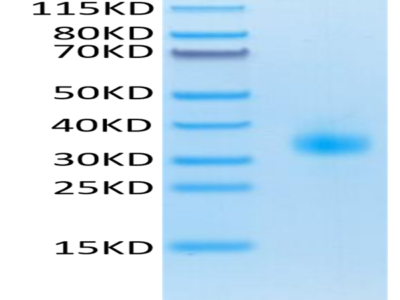 Mouse SOST/Sclerostin Protein (SOT-MM101)