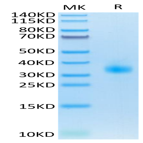 Mouse SOST/Sclerostin Protein (SOT-MM101)