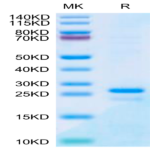 Human SP17 Protein (SP7-HE117)