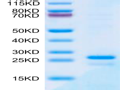 Human SP17 Protein (SP7-HE117)