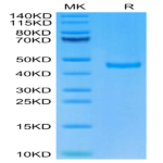 Cynomolgus SPARC Protein (SPA-CM101)