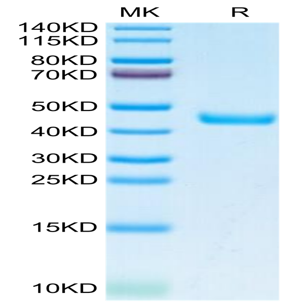 Human SPARC Protein (SPA-HM101)